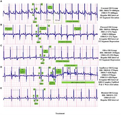 Consumption of edible oil blended with flax, coconut, sunflower, and olive oil can significantly improve the negative health consequences of high-fat/high-cholesterol diet in Sprague Dawley rats